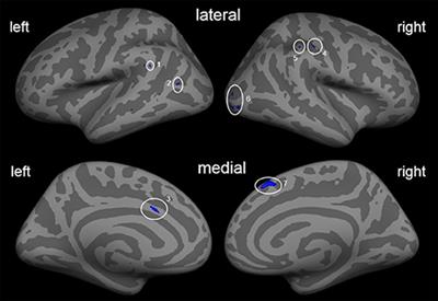 Preliminary Evidence for Training-Induced Changes of Morphology and Phantom Limb Pain